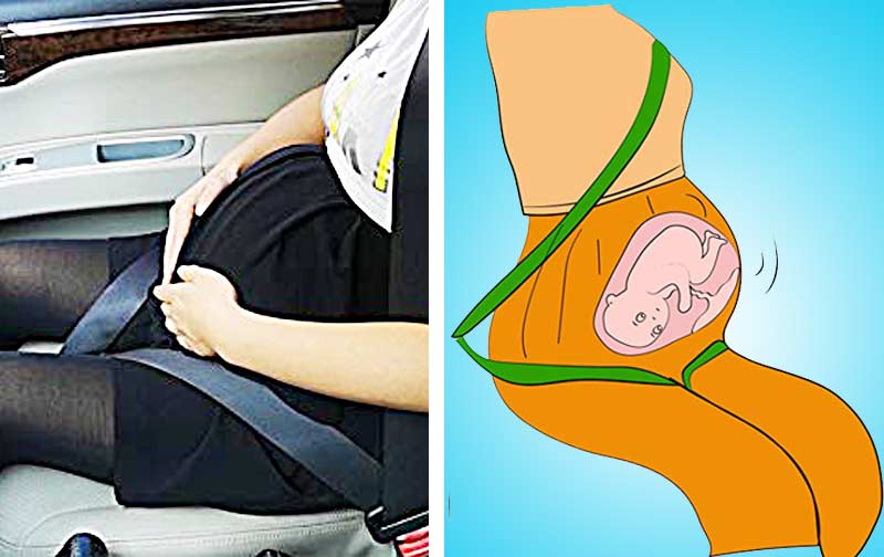 Anschnallgurt für Schwangere Schwangerschaft Auto